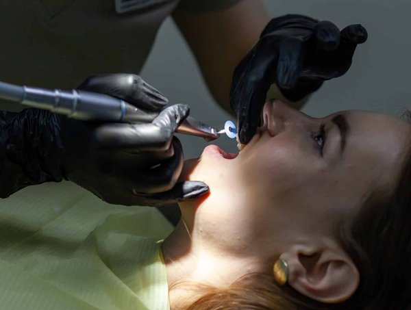 Comment obtenir un rendez-vous dentaire le jour même à Montréal ?