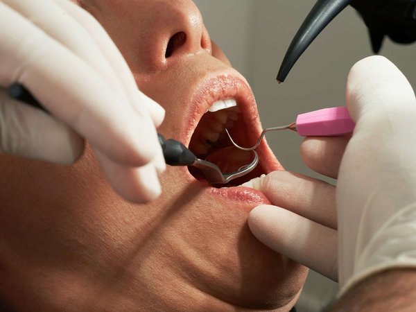 Où peut-on voir un dentiste rapidement à Montréal ?