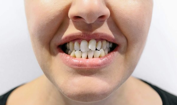 Comment évaluer la gravité d'un problème dentaire avant de voir un dentiste à Montréal ?