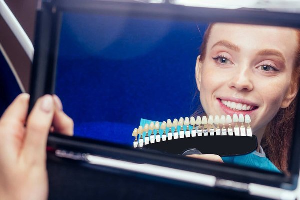 Les couronnes dentaires sont-elles disponibles à la clinique dentaire Prisma ?